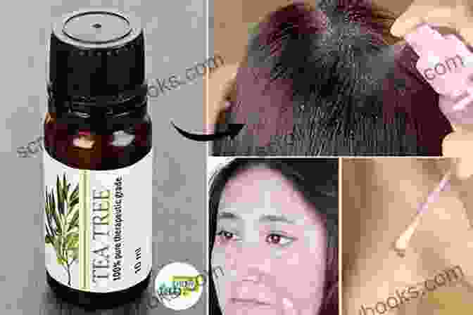 Woman Applying Tea Tree Oil To Her Face For Skincare The Ultimate Guide To Tea Tree Oil: Better Skin Hair And Health