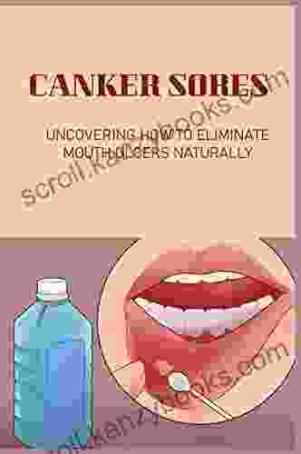 Canker Sores: Uncovering How To Eliminate Mouth Ulcers Naturally: What Causes Lots Of Mouth Ulcers?